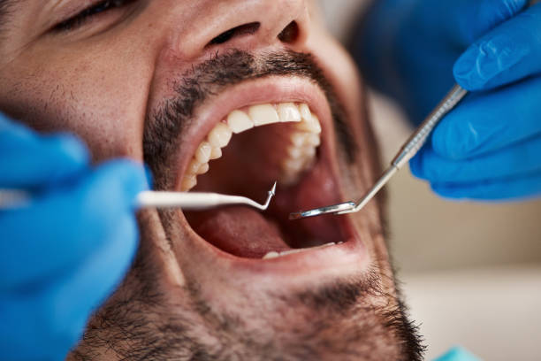 Best Dentist Open Late Near Me  in Lipatria, CA